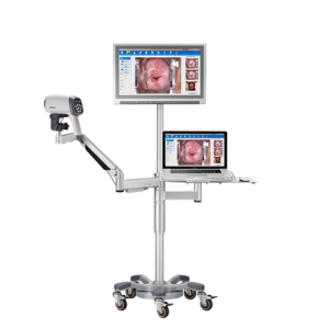 Colposcope